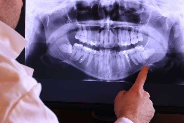 Best Emergency Dentist for Knocked-Out Tooth in Holiday Shores, IL