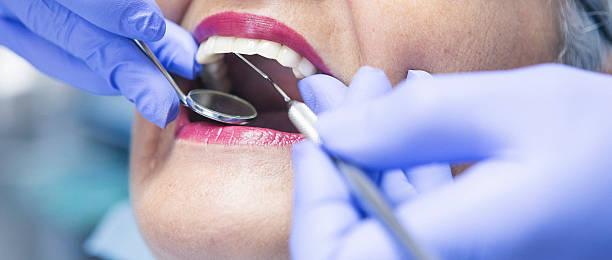 Best Emergency Dental Extractions in Holiday Shores, IL